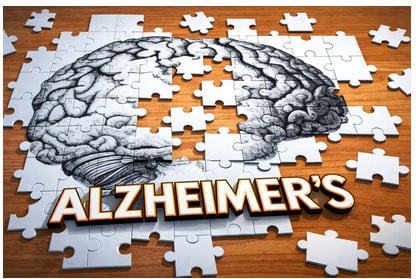 Alzheimers Disease Treatment  - Georgia Wellness Solutions - Griffin GA