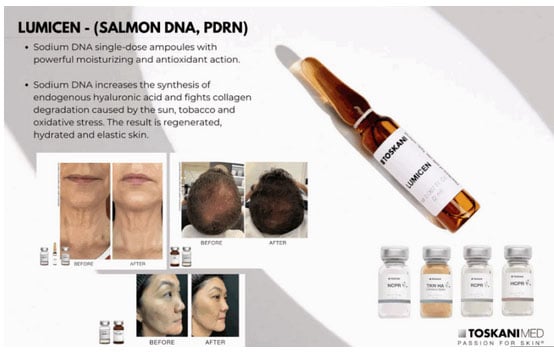 Fontana Laser, LUMICEN PDRN, Salmon DNA (PDN) Griffin, GA